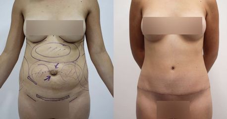 Dr Rodrigo Ruiz - RR Clinica