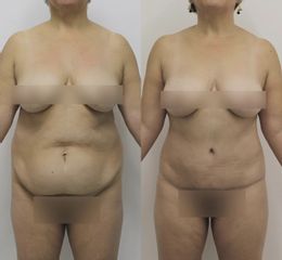 Dr Rodrigo Ruiz - RR Clinica
