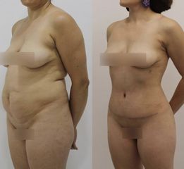 Dr Rodrigo Ruiz - RR Clinica