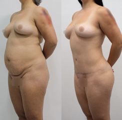 Dr Rodrigo Ruiz - RR Clinica