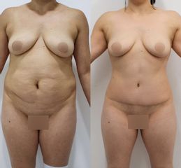 Dr Rodrigo Ruiz - RR Clinica