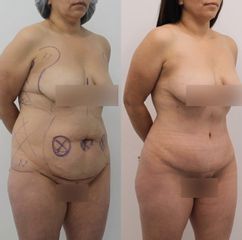 Dr Rodrigo Ruiz - RR Clinica
