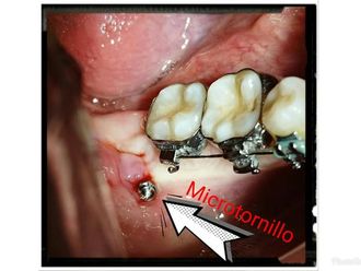 Ortodoncia - 632930