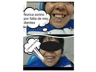 Prótesis dentales - 632932