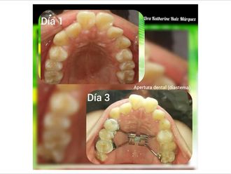Ortodoncia - 636601