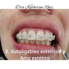 Ortodoncia - Dra. Katherine Ruiz
