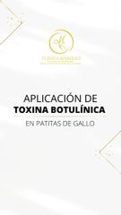 Botox - Dra. Katherin Ruiz Márquez