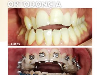 Ortodoncia - 822514