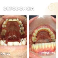 ortodoncia Dra. Katherin Ruiz Márquez