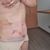 Abdominoplastia: volvi a mirar el espejo y a sentirme linda
