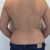 HIDROLIPOCLASIA! Una maravilla