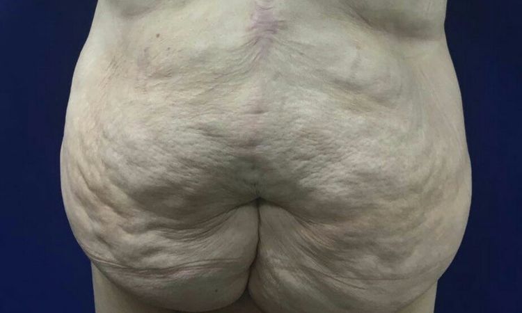 16857