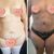 Un cambio radical 😍 - abdominoplastia con el Dr Freddy Carrasco