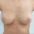 Feliz con mis resultados, se ven hermosas y  naturales, recomiendo 100% al Dr Figuer