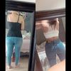 Lipovaser con transferencia Dra. Keila Figuera 100% recomendada