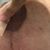 Mami make over, abdomen, mamas, liposucción y lipo transferencia