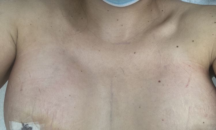 125046