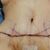 Abdominoplastia, me operé el 19 de julio con el dr Arturo Aguirre en la clínica Huinganal.