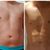 LipoVaser! Hombres! Recomendado