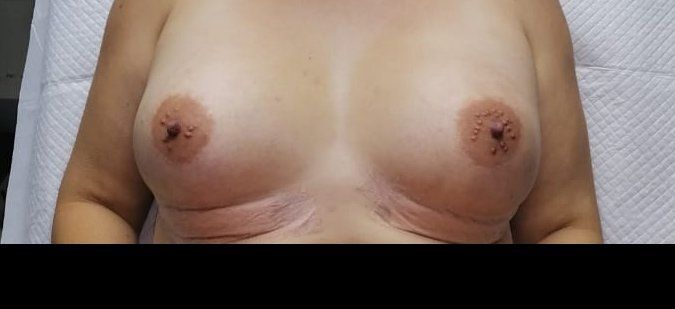120307