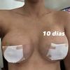 Pexia periaerolear 350cc perfil extra alto motiva Dr. Carlos Montiel