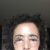 Blefaroplastia Dr Alvaro Sanchez Vargas