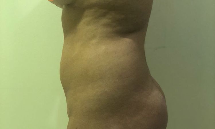 56470