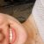 Blanqueamiento dental