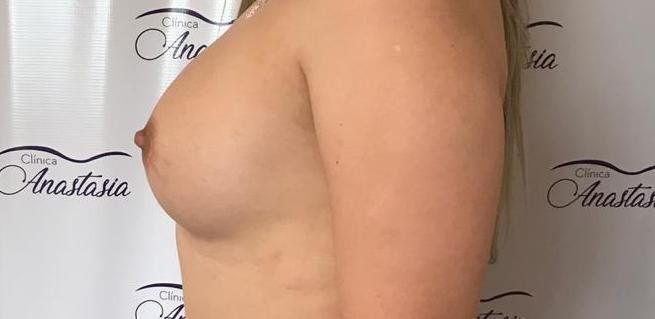 63812