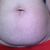 Estoy decidida a hacerme un abdominoplastia+ lipo+ relleno de glúteos.