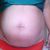 Estoy decidida a hacerme un abdominoplastia+ lipo+ relleno de glúteos.