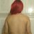Lipovaser + tgg e implantes mamarios