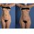 A tres meses de mi liposuccion y aun no veo grandes cambios