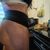 Cirujía de Abdominoplastia