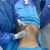 Me realice una Lipoescultura con el Dr Julian Diaz Santamaria