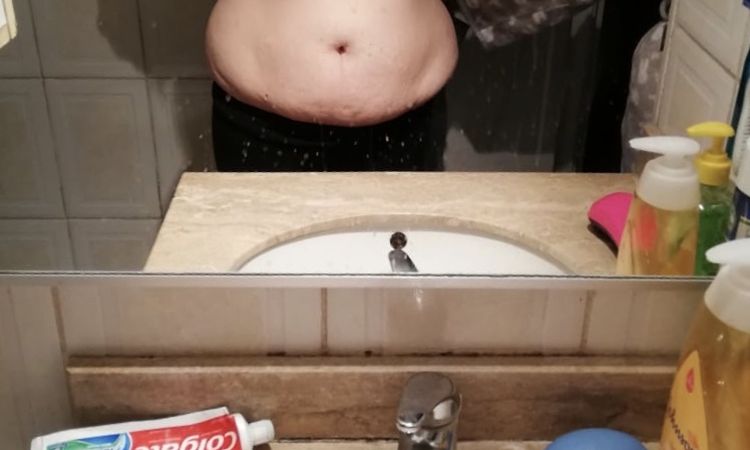 78557
