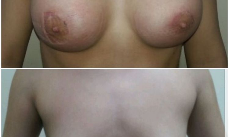 66485