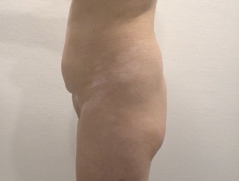 128531
