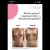 Abdominoplastia y mastopexia con implantes... ¿por qué no lo hice antes?