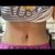 Abdominoplastia, me operé el 19 de julio con el dr Arturo Aguirre en la clínica Huinganal.