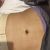 LIPOESCULTURA y PEXIA EN ARGENTINA