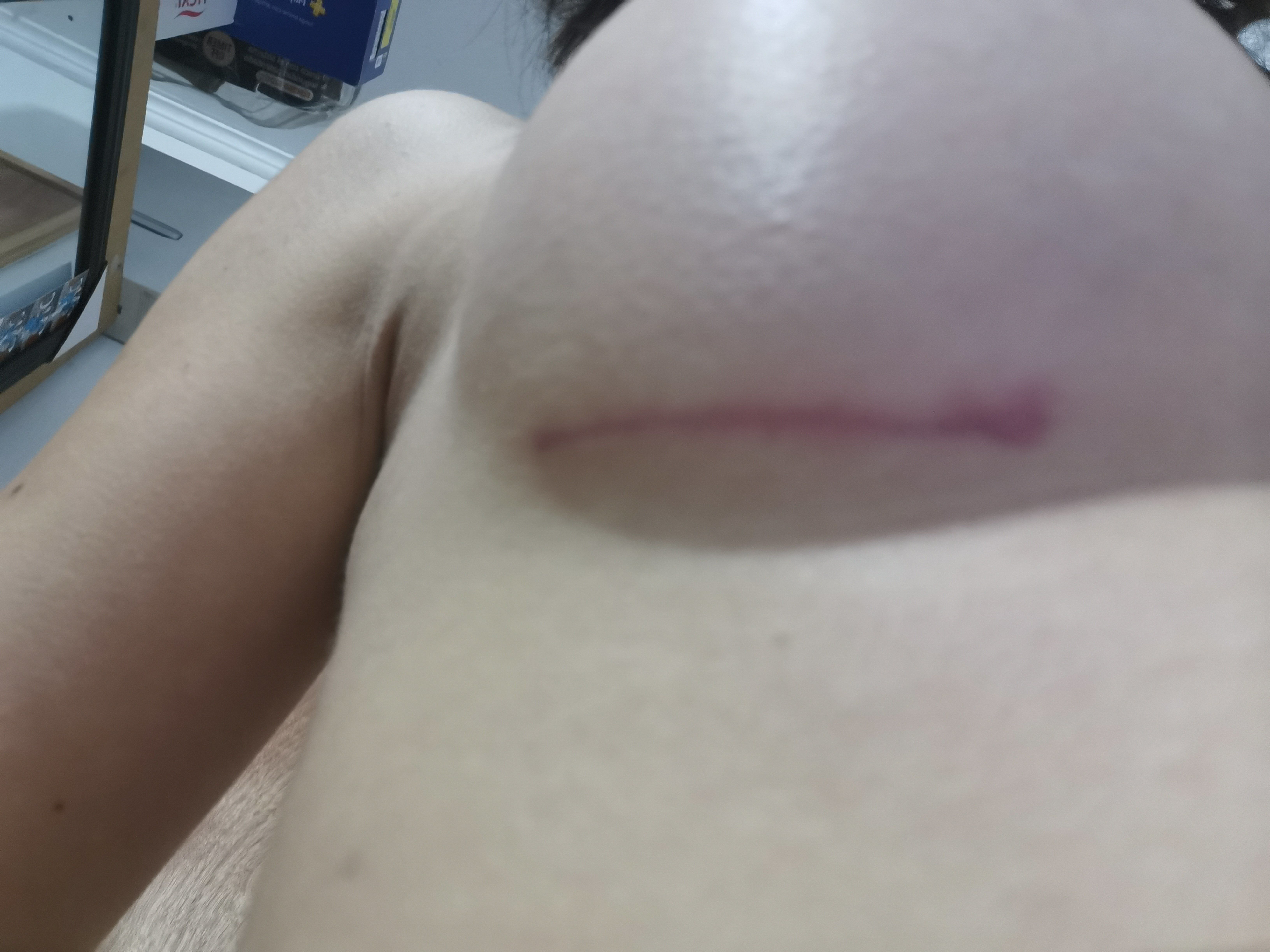 16010