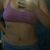 Lipoabdominoplastia 6 dias de operada estoy muy feliz