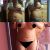 A 4 días de mi lipoescultura