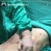 Experiencia liposuccion 3D con dr. Cesar Gonzales Colombiano