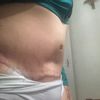 Ojo: Información importante antes de operarse