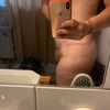 Ojo: Información importante antes de operarse