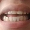 Consulta ortodoncia/mordida