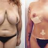 Gracias Clinica Di'Vinna y al Doctor Catalán