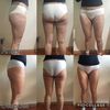 un remedio para la celulitis